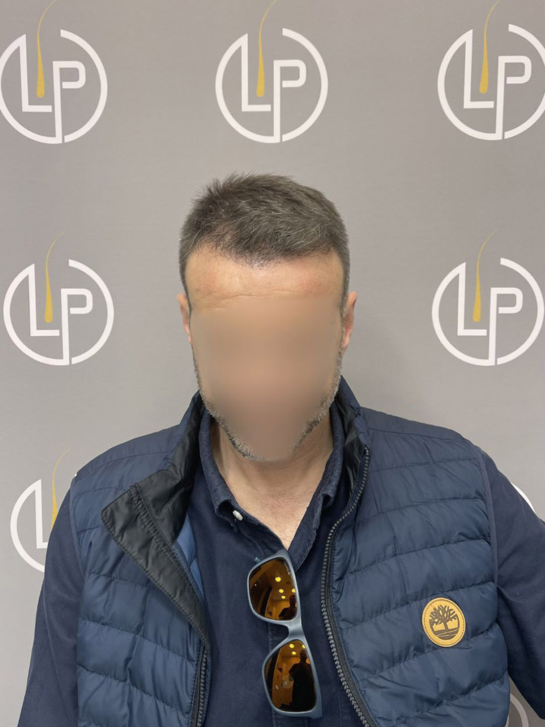 Περιστατικό 2 — μετά