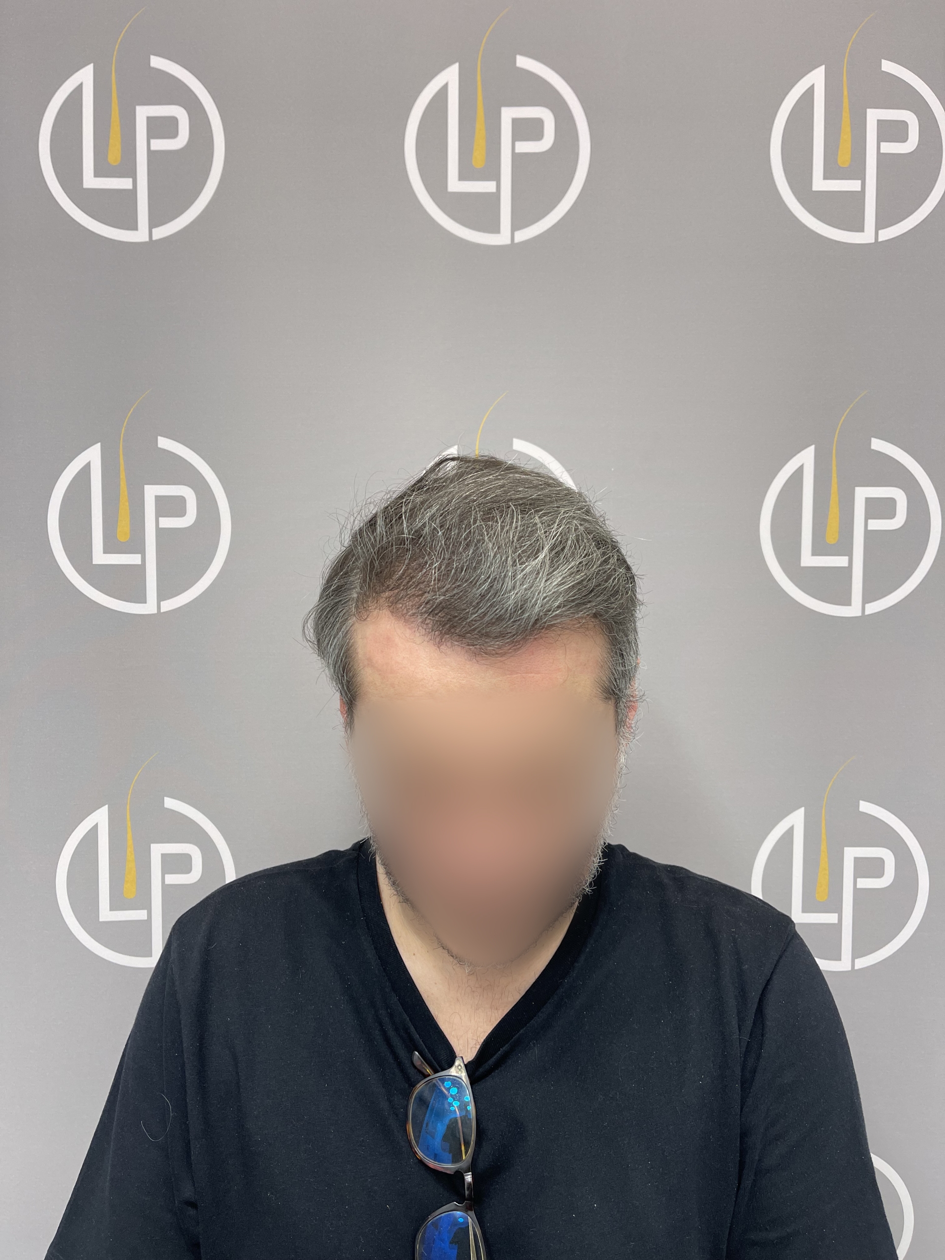 Περιστατικό 4 — μετά