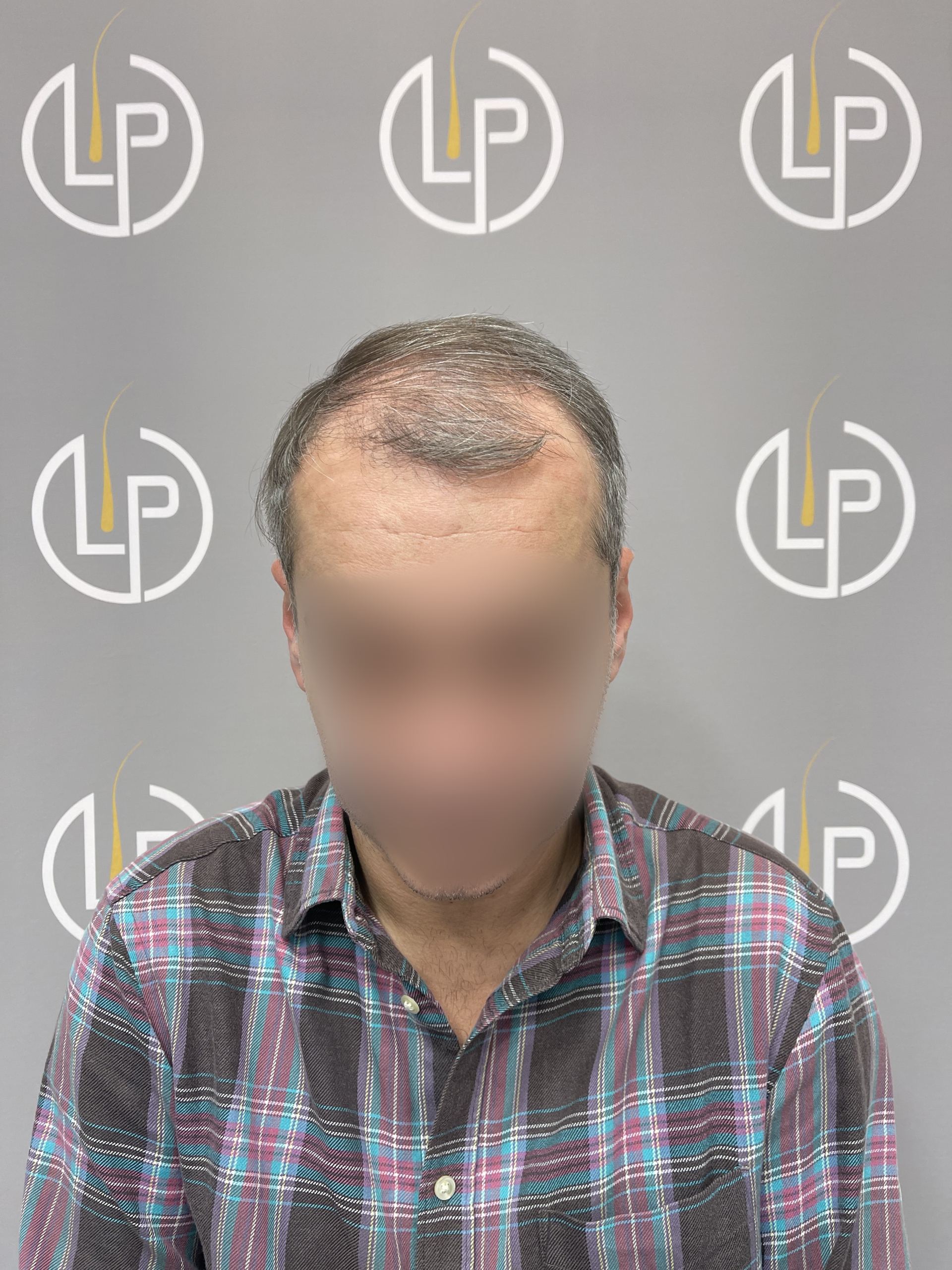 Περιστατικό 4 — πριν