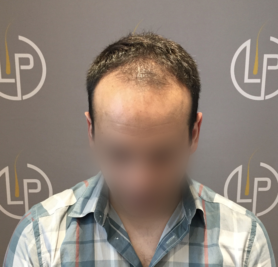 Περιστατικό 6 — πριν